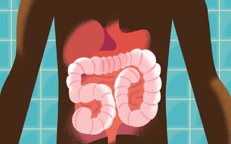 Colon Checkup and Colorectal Cancer