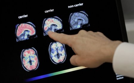 Are brain scans even accurate?