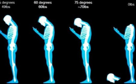 Tech neck: why is it created and how can it be prevented?