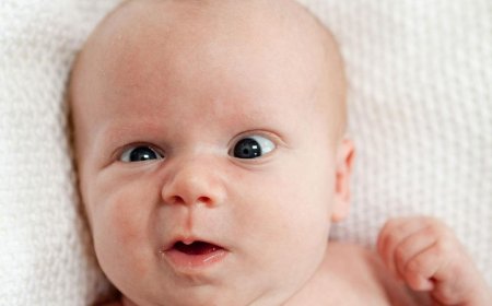 Strabismus baby: causes, diagnosis and treatment