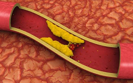 High cholesterol in children: is there anything to worry about?