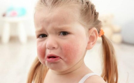 Children's allergy tests: what are they?